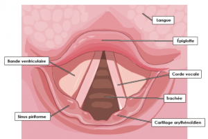 chirurgie cordes vocales voix grave en anglais